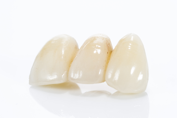 Is A Dental Bridge The Best Way To Replace A Missing Tooth?