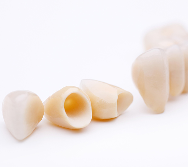 Jackson Heights Dental Crowns