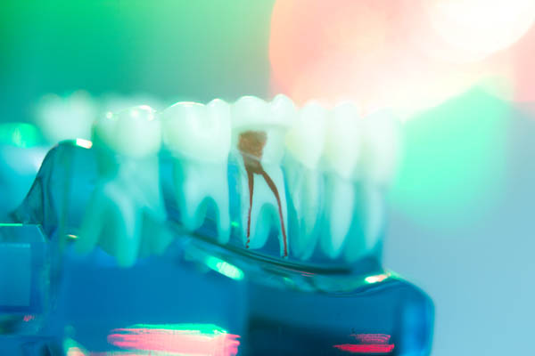 When Is Endodontics Necessary?