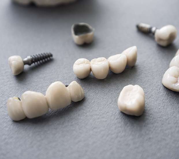 Jackson Heights The Difference Between Dental Implants and Mini Dental Implants
