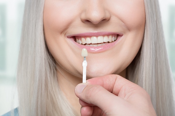 Aspects You Will Love About No Prep Veneers [Cosmetic Dentistry]