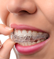 Clear Aligners - Almost Invisible Braces Jackson Heights, NY