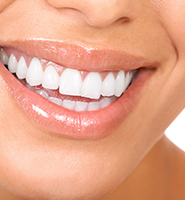 Teeth Whitening Services Jackson Heights, NY