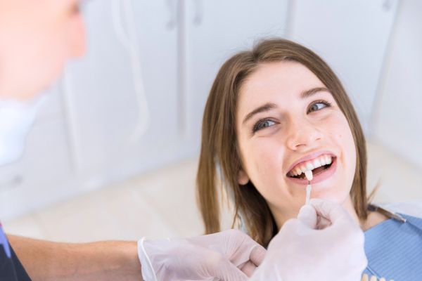 Frequently Asked Questions About Dental Veneers