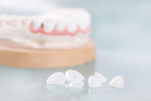 Proper Care For Your No Prep Veneers &#    ; Tips From A Cosmetic Dentist